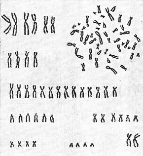 хромосомний набір жінки