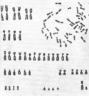 хромосомний набір чоловіки