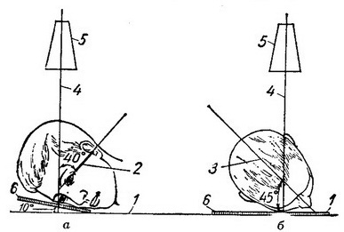 положення голови при рентгенографії зорового каналу