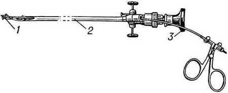 операційний цистоскоп