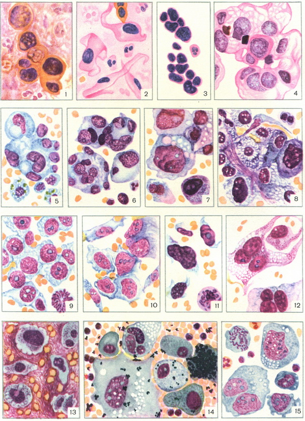 цитологічна діагностика