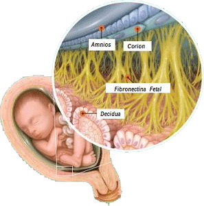 децидуальної оболонка