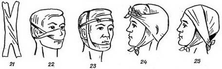 пращевидная пов'язка