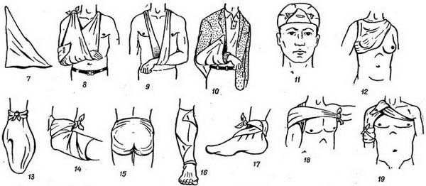 косыночные пов'язки