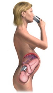 вагітність і алкоголь