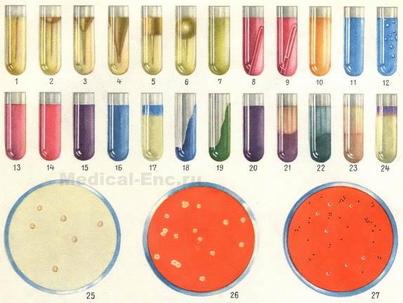 диференційно-діагностичні середовища