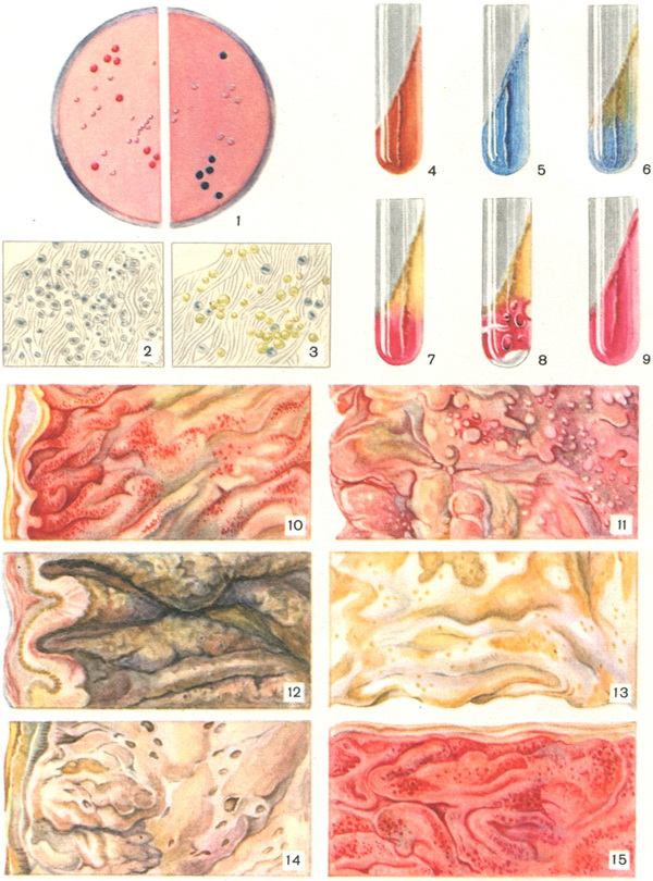 лабораторна діагностика дизентерії