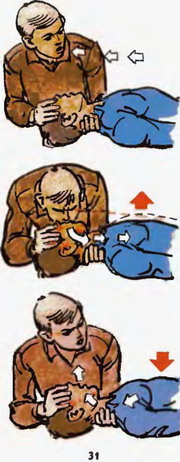 штучне дихання