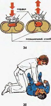 масаж серця