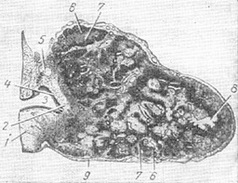 шишкоподібна залоза
