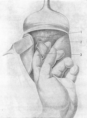 під стравохід підведений палець
