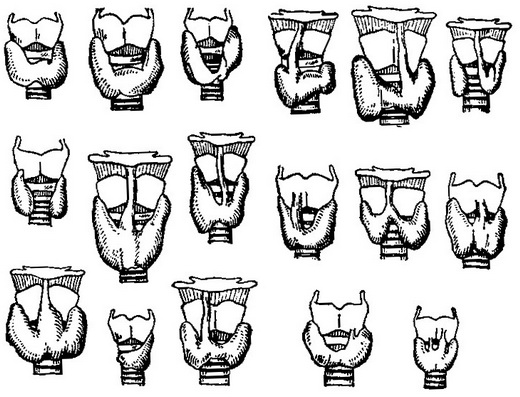 аномалії щитовидної залози