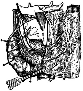 капсули щитовидної залози