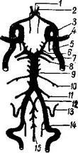 схема артерій основи мозку