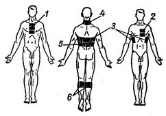 як правильно ставити гірчичники