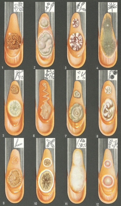 грибки паразитичні