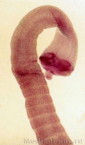 карликовий ціп'як