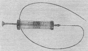 голка для эндовезикальной новокаїнової блокади