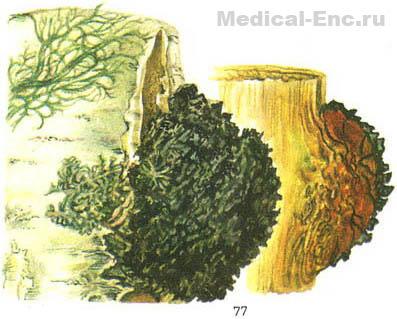 березовий гриб чага