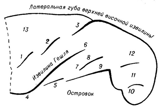 схема борозен і звивин верхній поверхні скроневої частки (нижньої стінки латеральної борозни) лівої півкулі