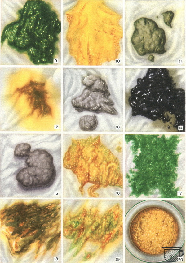 кал дитини раннього віку