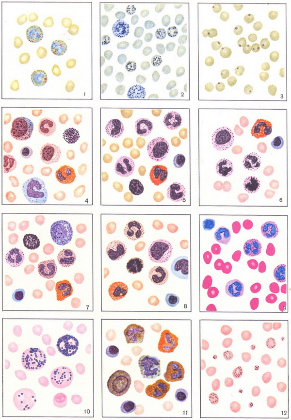 картина крові при різних методах фарбування