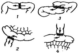 види анастомозів