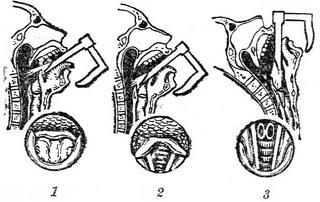 пряма ларингоскопія