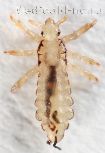 головна воша