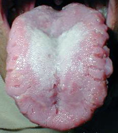 складчастий мову фото