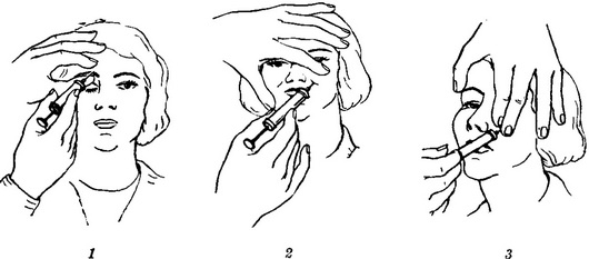 алкоголізація