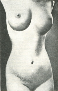 зовнішня форма молочних залоз