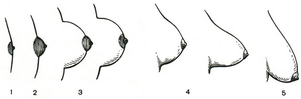 вікові особливості форми молочної залози