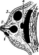мастит (абсцедуюча форма)