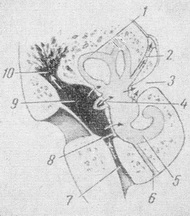 отогенний менінгіт