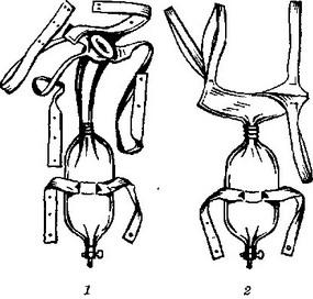 сечоприймач