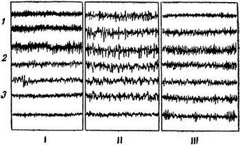 зміни електричної активності мозку у кішки