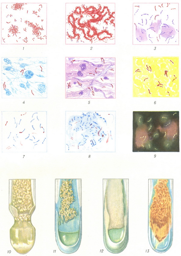мікобактерії туберкульозу