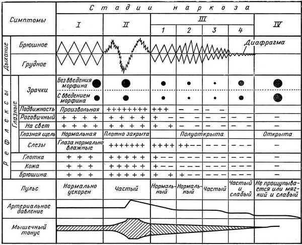 стадії наркозу