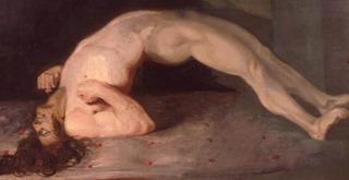 поза хворого на правець