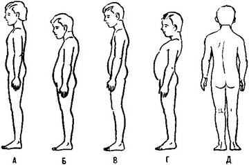 правильна постава та її порушення
