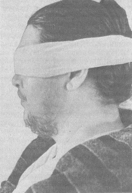 оволосіння за чоловічим типом