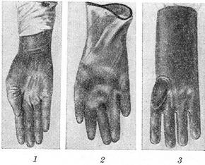 медичні рукавички 