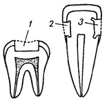 пломбування зубів