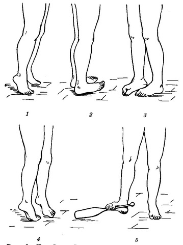 вправи при плоскостопості в картинках