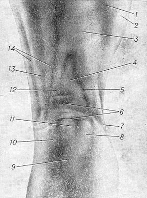 підколінна ямка