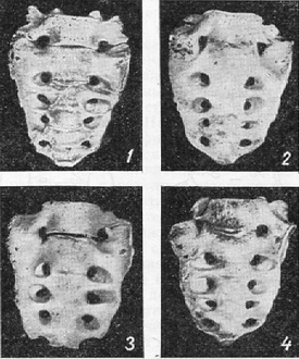 форми асиміляції хребця