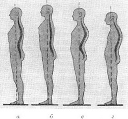 види постави