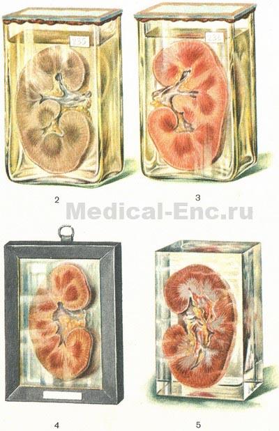 патологоанатомічні препарати