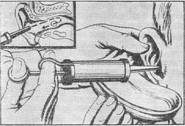 промивання вуха